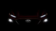 Hyundai Kona : la calandre et les phares